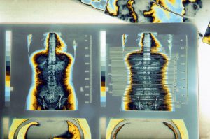Color Enhanced CT Scan X-Ray